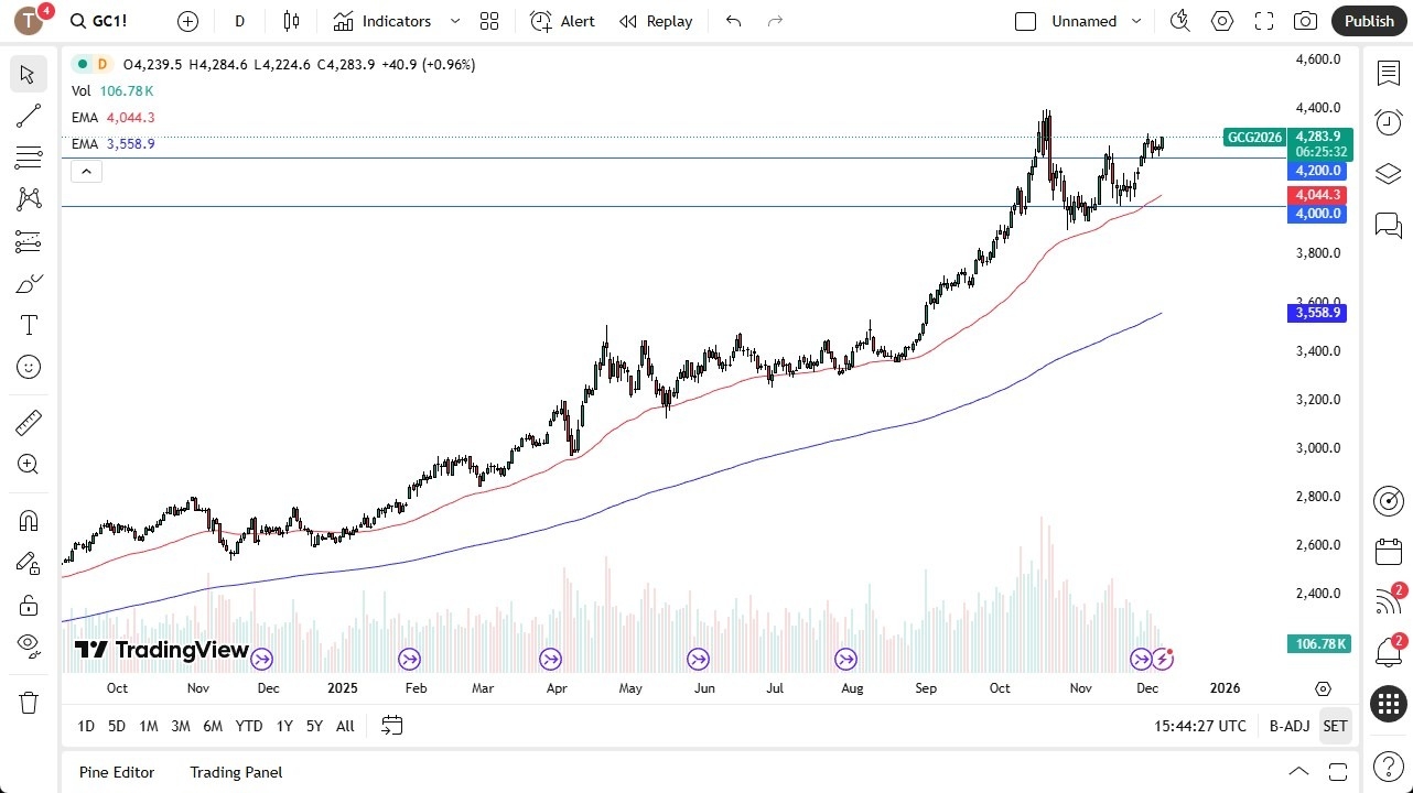 【XM Forex】--Gold Forex Signal: Continues to See Buyers(图1) 【XM Forex】--Gold Forex Signal: Continues to See Buyers(图1)